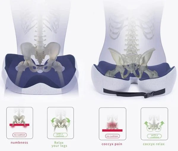 Adjustable Pressure Relief Cushion – Ergonomic Support Cushion